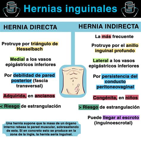 hernia inguinal en hombres - dia del ingeniero en mexico
